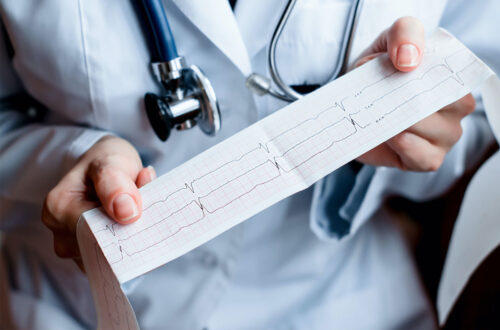 Ärztin hält ein Elektrokardiogramm (EKG) in der Hand, das Herzfrequenz und Herzrhythmus anzeigt, während ein Stethoskop um den Hals hängt.