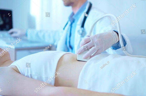 Ärztliche Untersuchung mit Ultraschallgerät bei einer Patientin im weißen Oberteil. Der Arzt trägt einen weißen Kittel und Handschuhe, während er das Gerät an den Bauchbereich anlegt. Im Hintergrund ist ein Computer sichtbar, der möglicherweise die Ultraschallbilder anzeigt.