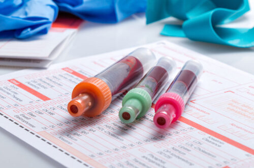 Blutproben in verschiedenen Entnahmeröhrchen (orange, grün, pink) auf einem Laborformular für Blutuntersuchungen. Im Hintergrund sind medizinische Handschuhe und Dokumente sichtbar.