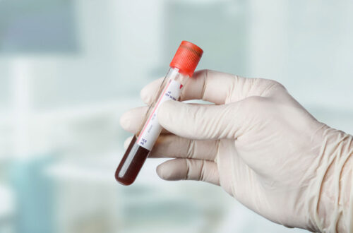 Hand mit Untersuchungshandschuh, die ein Blutprobenröhrchen mit rotem Deckel hält, im Hintergrund eine unscharfe medizinische Umgebung.