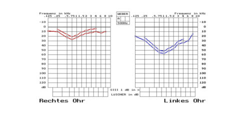Grafische Darstellung der Hörtest-Ergebnisse für das rechte (rot) und linke Ohr (blau) mit Frequenzen in kHz und dB. Die Diagramme zeigen die Hörsensitivität in verschiedenen Frequenzbereichen.